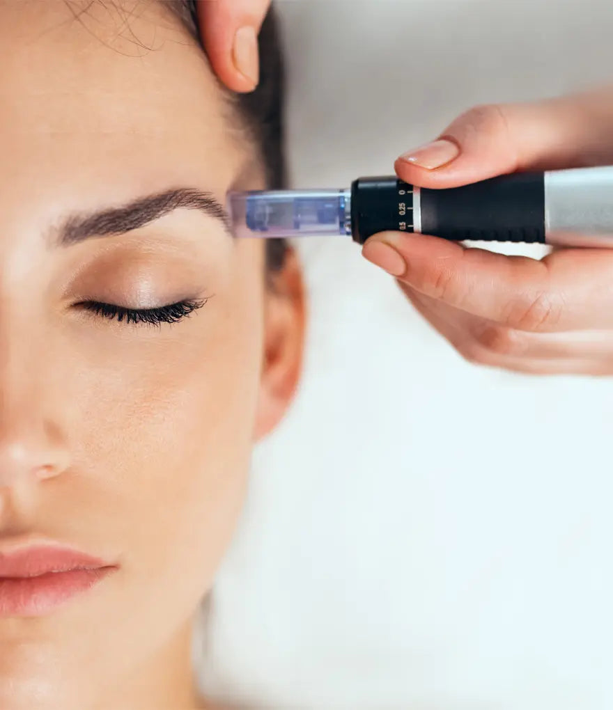 ✨ Micro Needling Glow Treatment — £65 (Was £80)