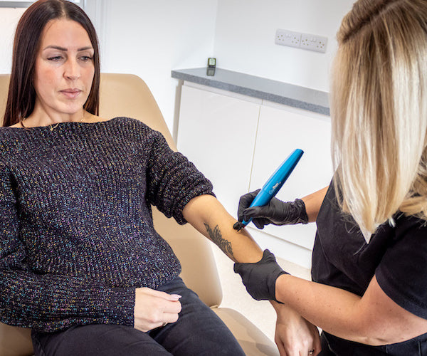 Skin Tag Removal with CryoPen – Only £49 per Area